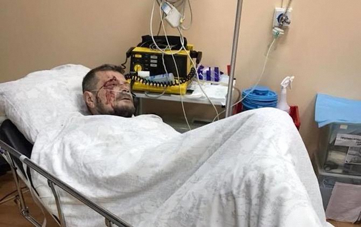 "Тяжело раненый" Мосийчук заявил, что его хотели убить патриоты-радикалы