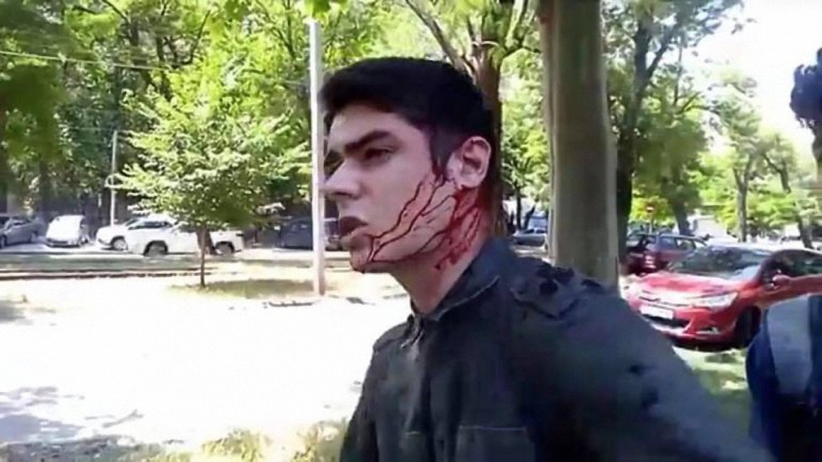 Нападение на активиста Устименко: охрану предоставили через две недели после покушения