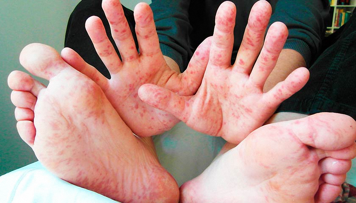 В школах Львовской области ввели точечный карантин - фото 1