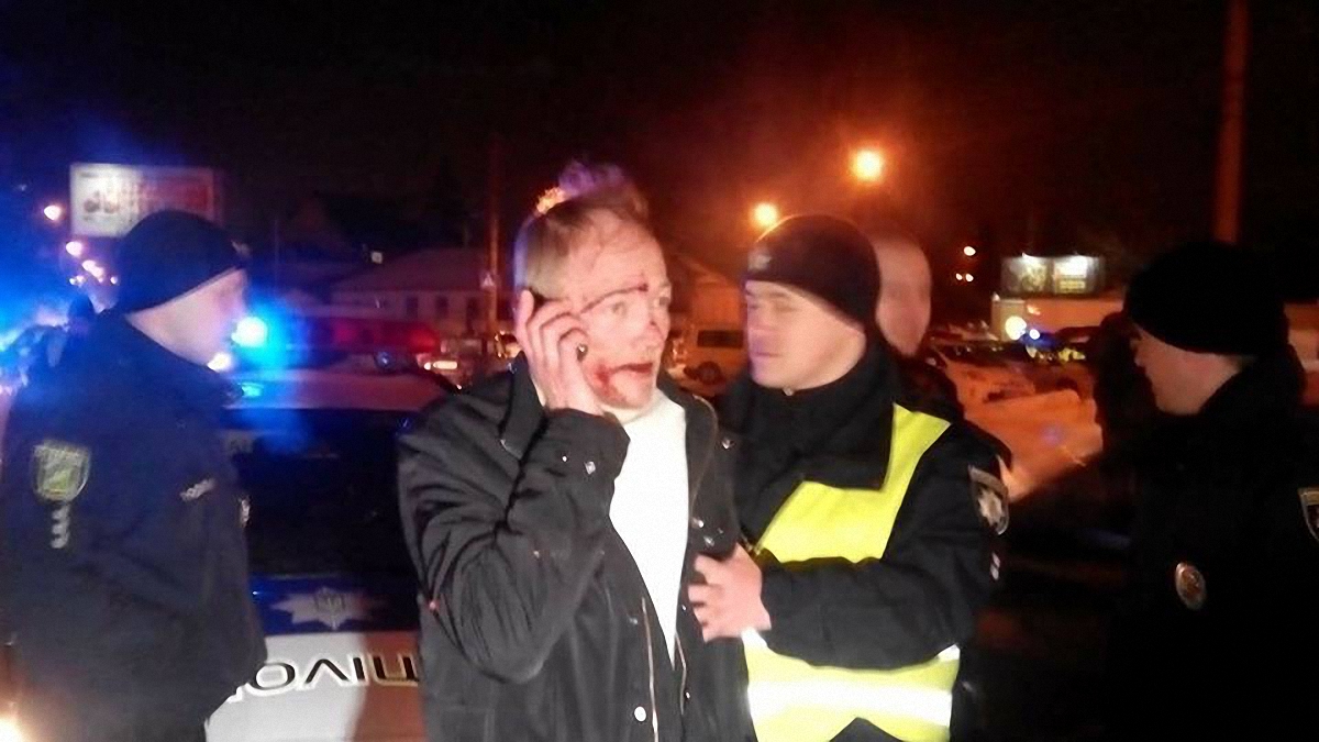 Пьяный водитель устроил пять ДТП в Харькове - фото 1