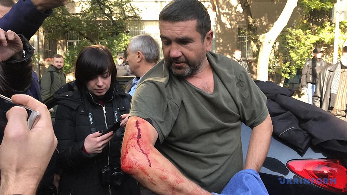 Одного из нападавших на корреспондента пропагандистского канала задержали - фото 1