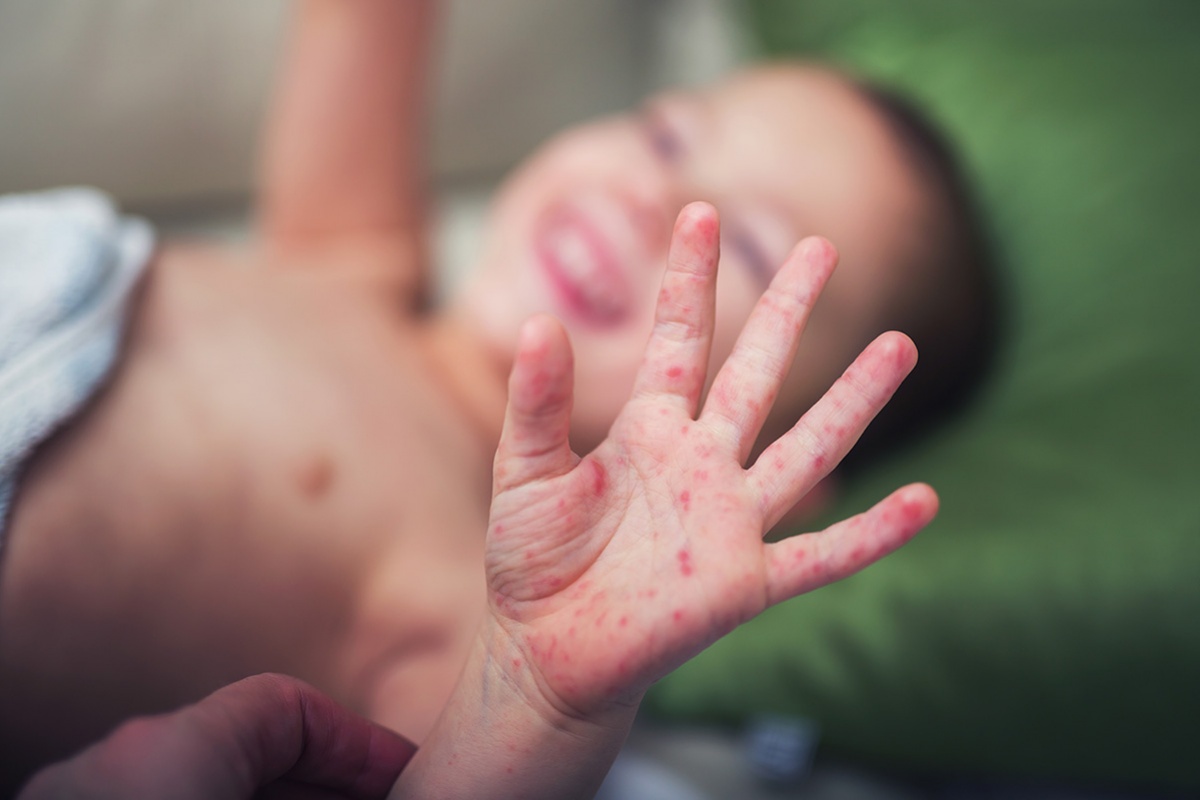На Прикарпатье вакцина есть только для детей - фото 1