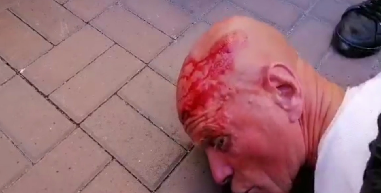 Разбили голову: Мужчина хотел "увидеть Зеленского" – ФОТО - фото 1