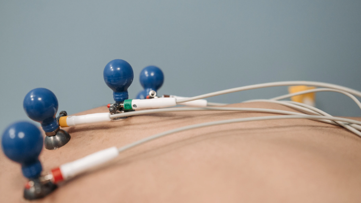 Як регулярне ЕКГ допомагає уникнути раптових серцевих нападів - фото 1