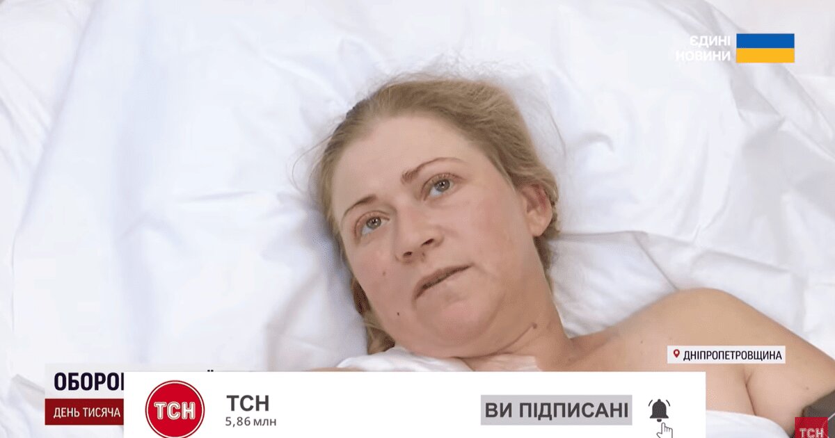 Закрила собою трирічного сина від удару дрона: у Дніпрі рятують жінку, яка постраждала під час атаки на Марганець - фото 1