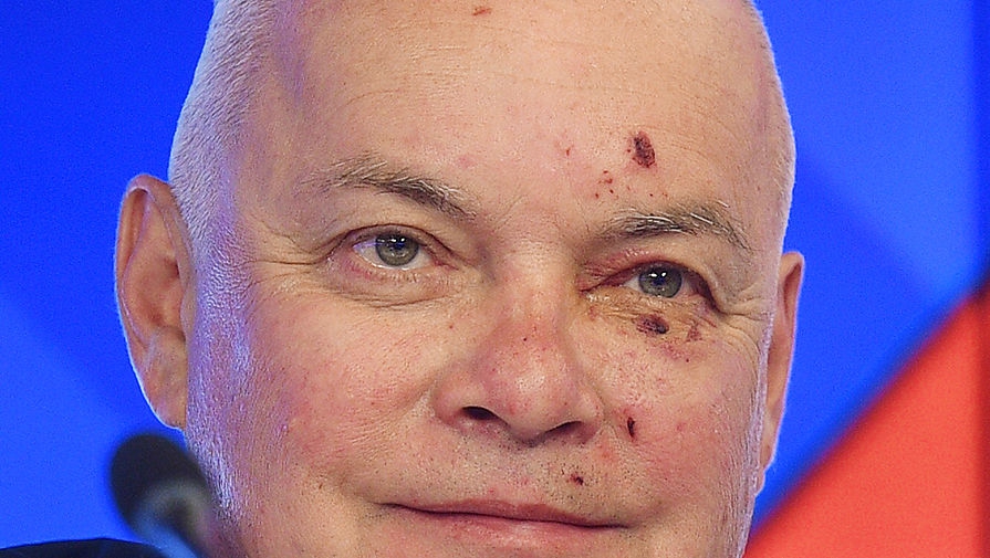 Ударился об оккупированный Крым. Топовый пропагандист Кремля разбил лицо - 46080 Ударился об оккупированный Крым. Топовый пропагандист Кремля разбил лицо - фото 46080