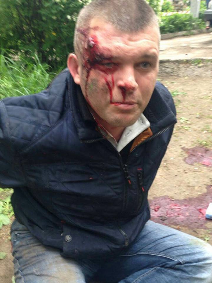 В Каменском охрана Яроша прострелила ноги таксисту, который не сказал "Слава Украине" - 46513 В Каменском охрана Яроша прострелила ноги таксисту, который не сказал "Слава Украине" - фото 46513