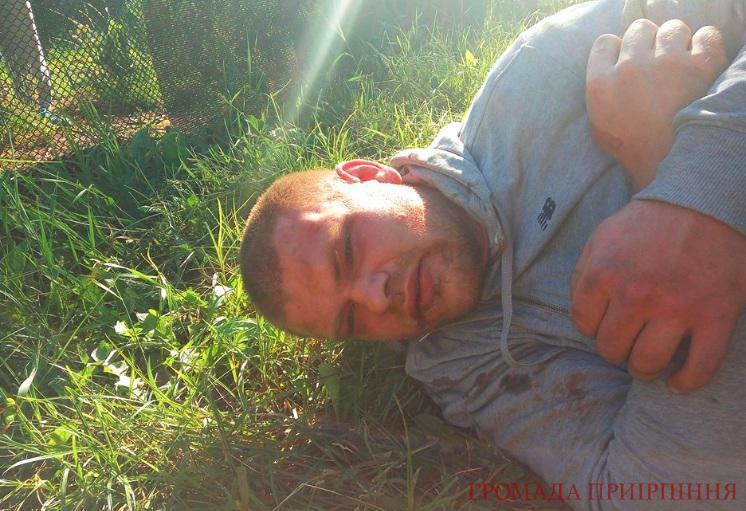 Под Киевом жестоко избили главу избирательной комиссии - 51421 Под Киевом жестоко избили главу избирательной комиссии - фото 51421