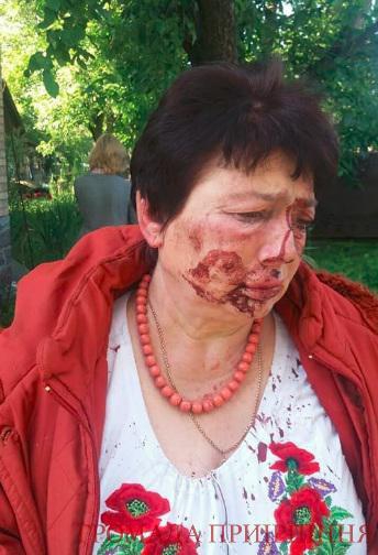 Под Киевом жестоко избили главу избирательной комиссии - 51422 Под Киевом жестоко избили главу избирательной комиссии - фото 51422