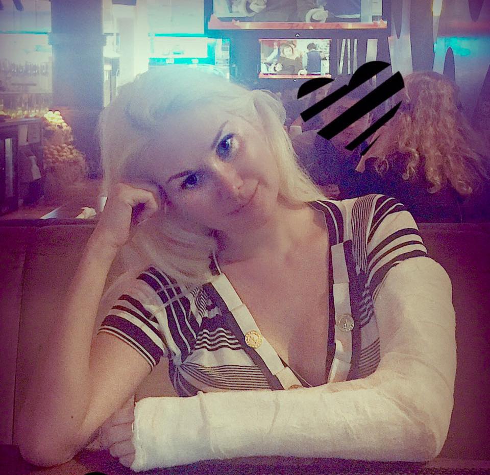 Екатерина Бужицкая сломала руку - 57017 Екатерина Бужицкая сломала руку - фото 57017