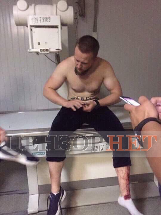Боец АТО сообщил, кто открыл стрельбу в Днепре - 60477 Боец АТО сообщил, кто открыл стрельбу в Днепре - фото 60477