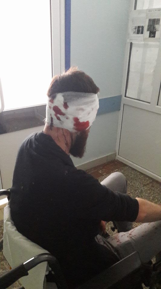 В Харькове депутата-антикоррупционера избили прямо средь бела дня - 70300 В Харькове депутата-антикоррупционера избили прямо средь бела дня - фото 70300