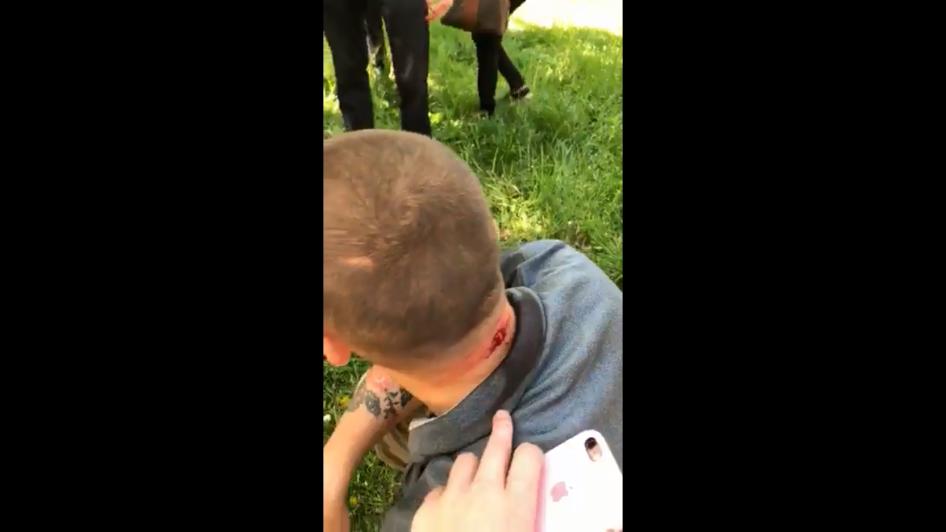 В Одессе подстрелили бывшего главу 'Правого сектора' - 122639 В Одессе подстрелили бывшего главу 'Правого сектора' - фото 122639