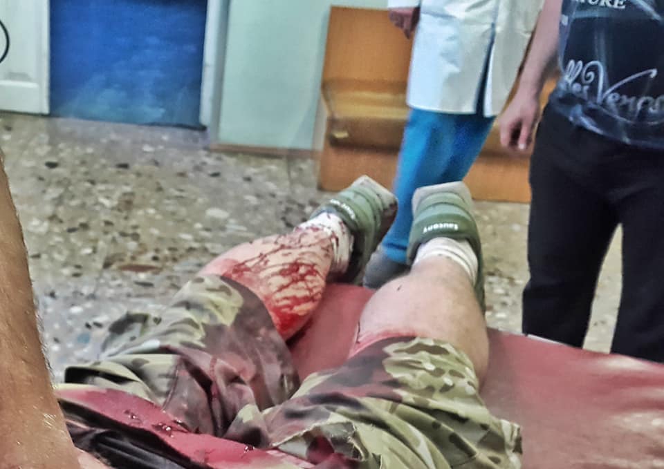 В Киеве напали ветерана АТО, который защищал ДАП - 122861 В Киеве напали ветерана АТО, который защищал ДАП - фото 122861