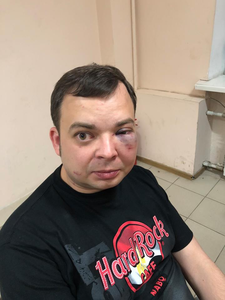 В киевском ресторане избили Шуфрича (ФОТО) - 124767 В киевском ресторане избили Шуфрича (ФОТО) - фото 124767