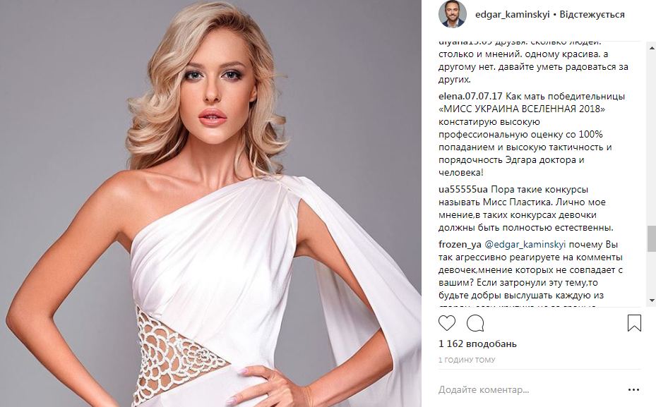 Какие пластические операции сделала Мисс Украина Вселенная 2018 Карина Жосан - фото 141523