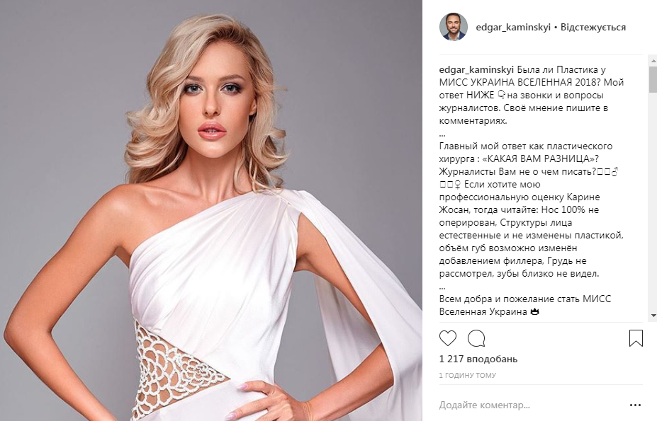 Какие пластические операции сделала Мисс Украина Вселенная 2018 Карина Жосан - фото 141524