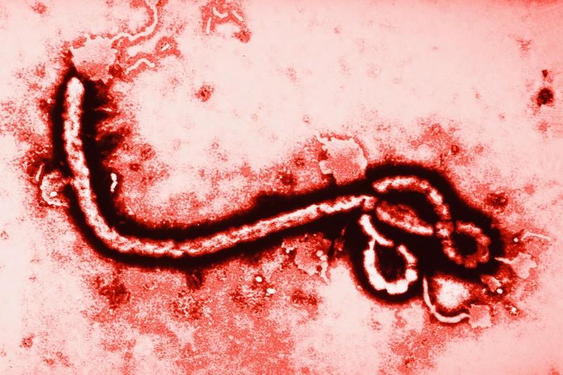 Вирус Эбола - стоит ли бояться украинцам этой опасной  заразы - фото 184535