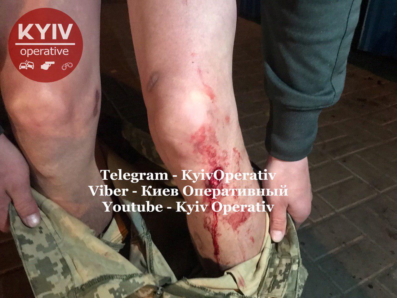 Пьяный военный расстрелял ветерана войны в Киеве (ФОТО+ВИДЕО 18+) - фото 189686