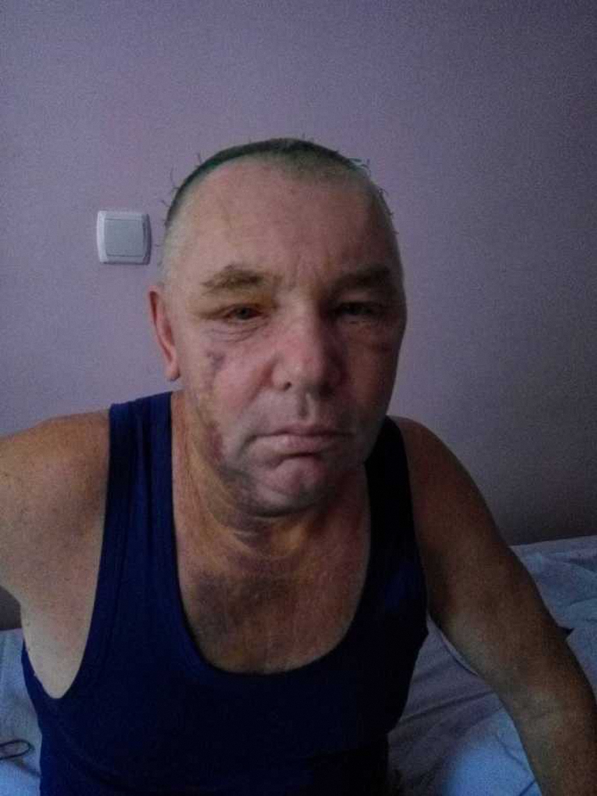 На Алексея Нагорнюка напали 10 человек - фото 1