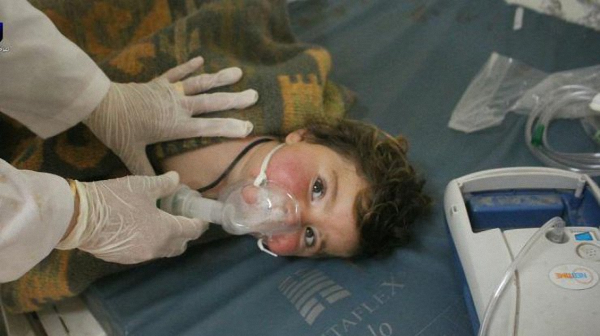 От применения химоружия в Сирии пострадали женщины и дети - фото 1