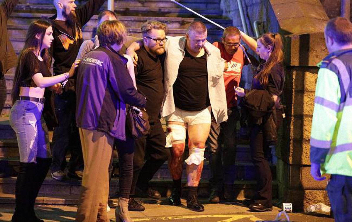 Точное количество пострадавших от рук террористов в Манчестере еще неизвестно - фото 1