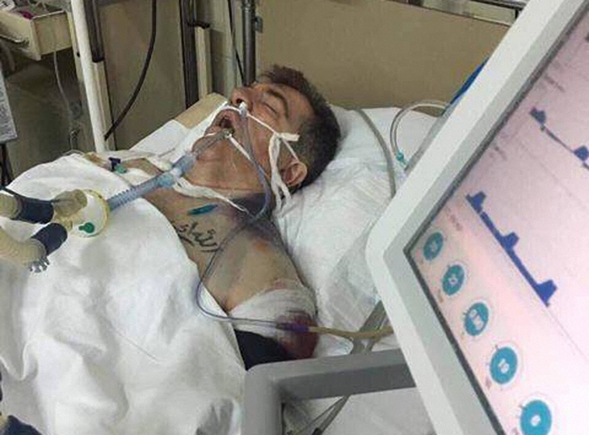 Личный киллер Кадырова находится на аппарате искусственного дыхания - фото 1