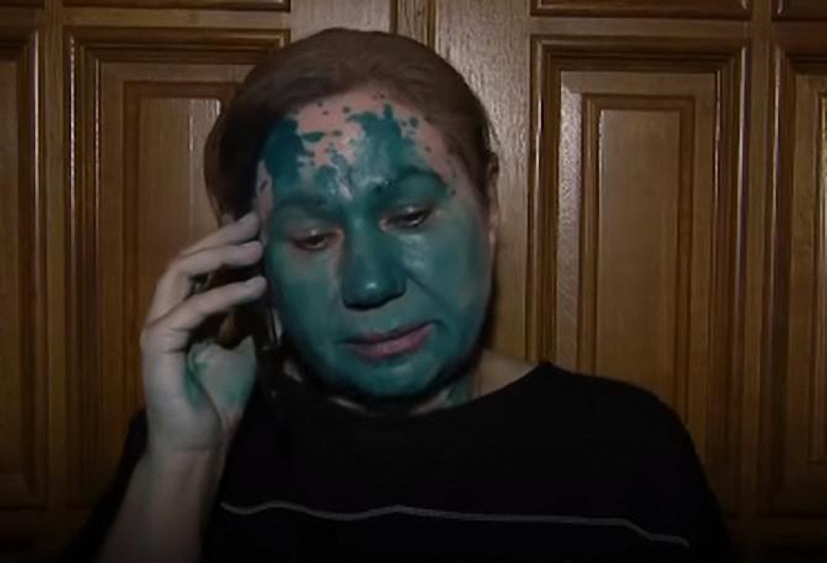 Елена Бережная намерена идти в ООН из-за зеленки на своем лице - фото 1