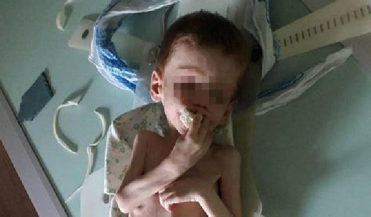 В Кировоградской области родители морили голодом своего четырехлетнего сына - фото 1