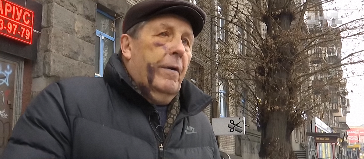 Полицейские в Киеве напали и избили 81-летнего пенсионера - фото 1